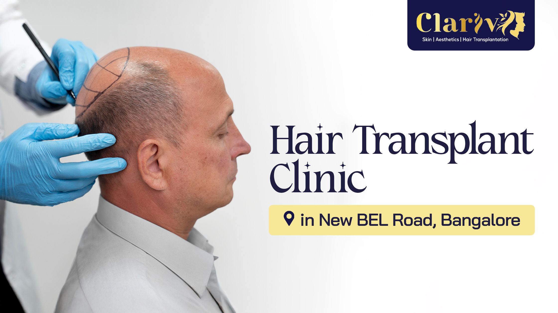Hair Transplant Clinic in New BEL Road