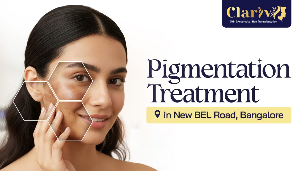 Pigmentation Treatment in New BEL Road