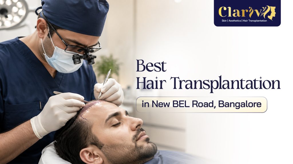 Best Hair Transplantation in New BEL Road